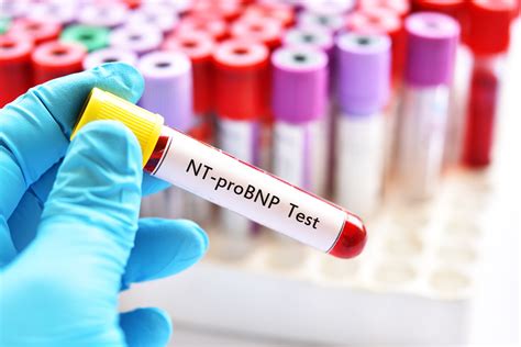 nt probnp blood test colour bottle|nt probnp test.